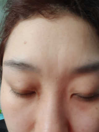 닥터존스킨 눈썹자라 — 5점을 준 리뷰어가 2020년 8월 올린 사용 사진