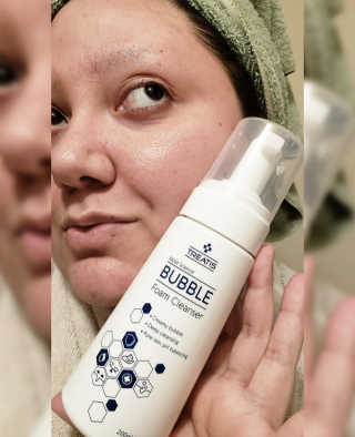 트리티스 [TREATIS] Bubble Foam Cleanser 200ml — 5점을 준 리뷰어가 2021년 1월 올린 사용 사진
