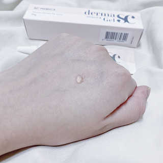 derma SC-Gel 더마에스씨 겔 20g — 5점을 준 리뷰어가 2020년 4월 올린 사용 사진