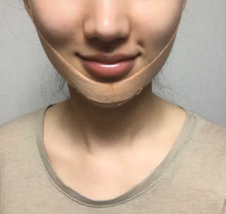 아이디플라코스메틱 아이디 페이스핏 마이너스 밴드 — 5점을 준 리뷰어가 2020년 5월 올린 사용 사진