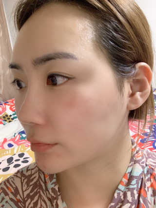 메디필 에스테 더마 유산균 콜라겐 클리어 — 3점을 준 리뷰어가 2020년 5월 올린 사용 사진