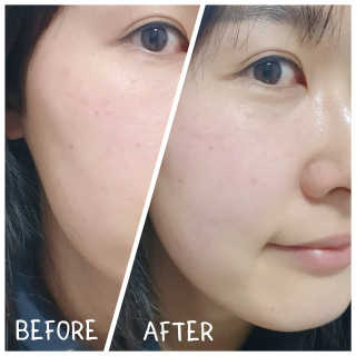 미구하라 프리미엄 울트라 화이트닝 퍼펙트 앰플 오리진  20ml — 3점을 준 리뷰어가 2020년 4월 올린 사용 사진