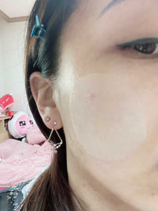자이엘 S.O.S 레드 칙 케어팩 2 Box — 5점을 준 리뷰어가 2020년 4월 올린 사용 사진