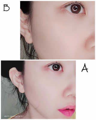 미구하라 프리미엄 울트라 화이트닝 퍼펙트 앰플 오리진  20ml — 5점을 준 리뷰어가 2020년 4월 올린 사용 사진