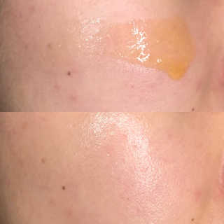 메디페르 루테인앰플 10ml 4개 — 4.5점을 준 리뷰어가 2020년 4월 올린 사용 사진