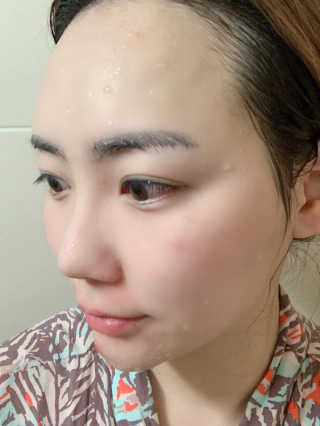 메디필 에스테 더마 유산균 콜라겐 클리어 — 3점을 준 리뷰어가 2020년 5월 올린 사용 사진