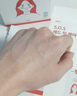 자이엘 S.O.S 레드 칙 케어팩 2 Box — 5점을 준 리뷰어가 2020년 4월 올린 사용 사진