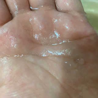 버츠비 이치수딩 스프레이 — 5점을 준 리뷰어가 2020년 9월 올린 사용 사진