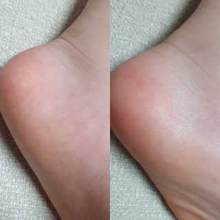 아밍이다님이 올린 리뷰 사진 2