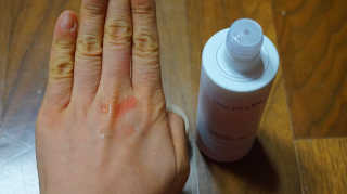 어글리프루프 에센스 스탑디어글리 레드모먼트 에센스 120ml — 5점을 준 리뷰어가 2020년 12월 올린 사용 사진