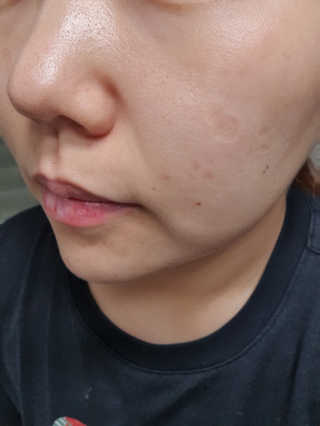 메디필 에스테 더마 유산균 콜라겐 클리어 — 4점을 준 리뷰어가 2020년 5월 올린 사용 사진