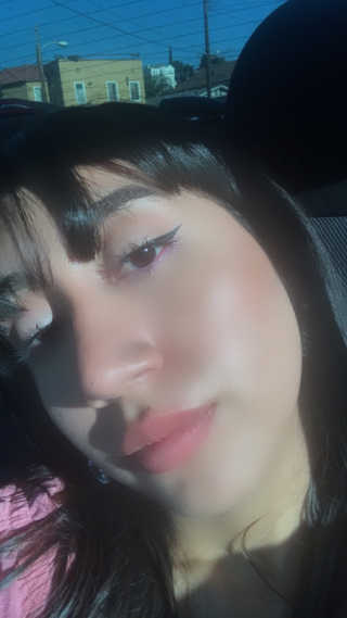 뷰트리 뷰티 트리 블레미쉬 카밍 트리트먼트 패드 — 5점을 준 리뷰어가 2020년 8월 올린 사용 사진