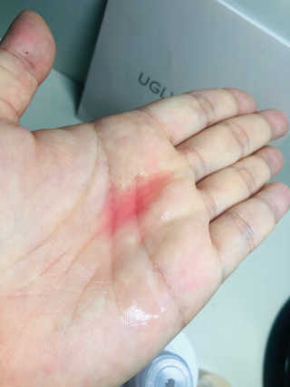 어글리프루프 에센스 스탑디어글리 레드모먼트 에센스 120ml — 5점을 준 리뷰어가 2020년 10월 올린 사용 사진