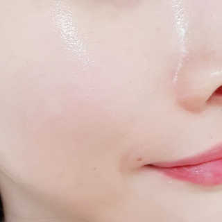 냉장고에 넣어요, 붉은 트러블 피부 다음날 진정되요 [버진팜스 푸딩수딩아토] — 5점을 준 리뷰어가 2020년 10월 올린 사용 사진