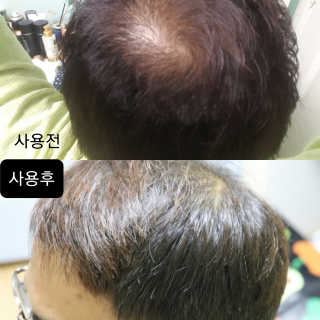 비타브리드 스칼프 샴푸 플러스 — 4점을 준 리뷰어가 2020년 5월 올린 사용 사진