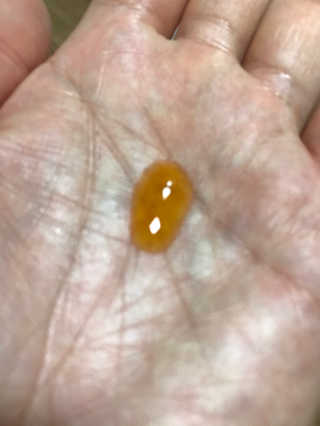 메디페르 루테인앰플 10ml 4개 — 5점을 준 리뷰어가 2020년 4월 올린 사용 사진