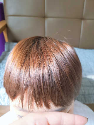 다슈코리아 다슈 데일리 탈모완화 초강력 헤어 스프레이 — 5점을 준 리뷰어가 2020년 10월 올린 사용 사진