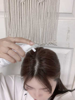 리더스코스메틱 리더스 헤어 라피 헤어 로스 컨트롤 토닉 — 5점을 준 리뷰어가 2020년 4월 올린 사용 사진