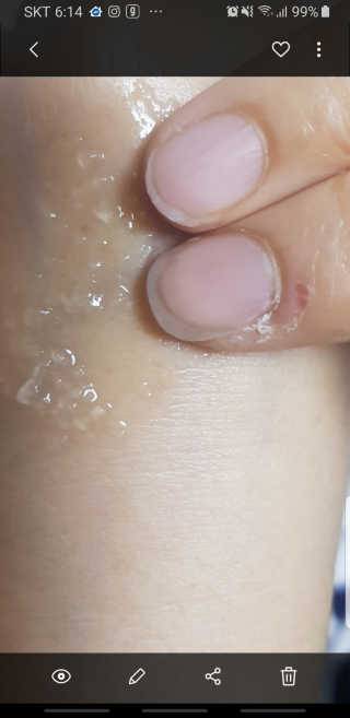 메디필 펩타이드9 볼륨 바이오 톡스 앰플 — 4점을 준 리뷰어가 2020년 10월 올린 사용 사진