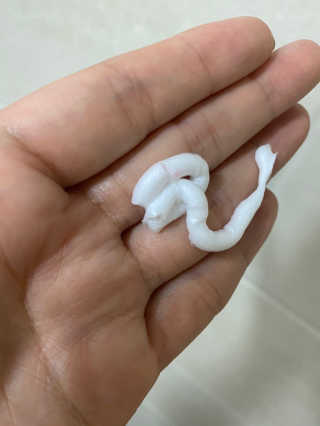 메디필 에스테 더마 유산균 콜라겐 클리어 — 4점을 준 리뷰어가 2020년 7월 올린 사용 사진