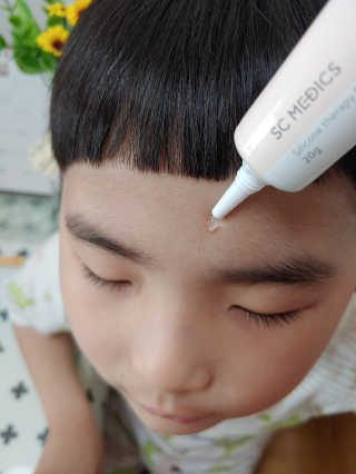 derma SC-Gel 더마에스씨 겔 20g — 5점을 준 리뷰어가 2020년 5월 올린 사용 사진