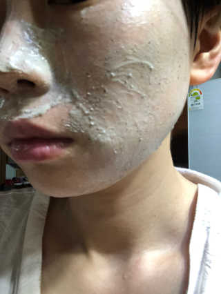 천사연구소 진짜 生병풀잎을 그대로  갈아 넣은 워시오프 센텔라팩 — 5점을 준 리뷰어가 2020년 7월 올린 사용 사진