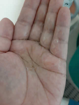 키라니아 피토스칼프 탈모완화 기능성샴푸 500ml — 5점을 준 리뷰어가 2020년 12월 올린 사용 사진