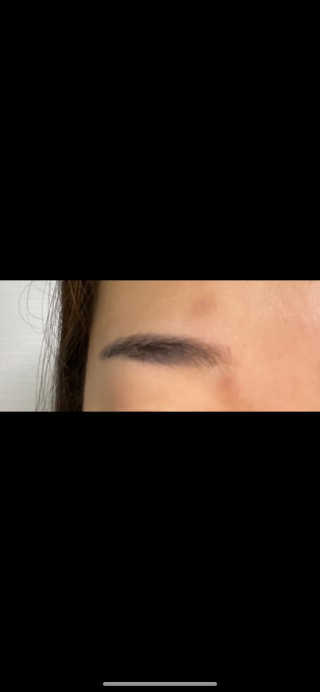 엘라밴드 하이드로 도트 스팟패치 12mm, 10mm — 5점을 준 리뷰어가 2020년 8월 올린 사용 사진