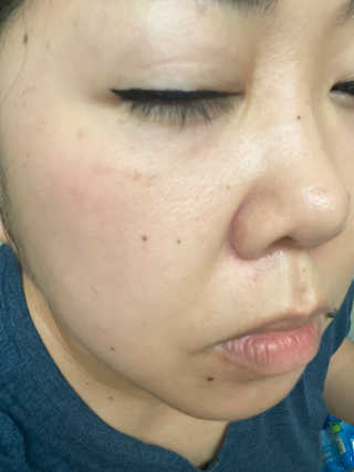 Emogurloveskincare님이 올린 리뷰 사진 4