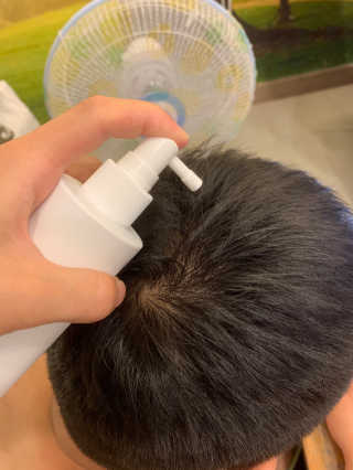 리더스코스메틱 리더스 헤어 라피 헤어 로스 컨트롤 토닉 — 4.5점을 준 리뷰어가 2020년 8월 올린 사용 사진