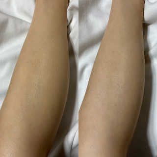 더마비 프레쉬 모이스처 바디 로션 — 5점을 준 리뷰어가 2020년 5월 올린 사용 사진