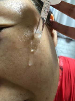 스와니코코 비타민 에센스 30ml — 5점을 준 리뷰어가 2020년 9월 올린 사용 사진