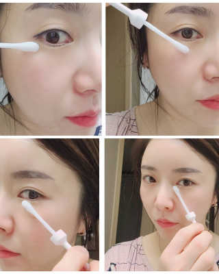 [오지랩] 애교살을 원하는 당신을 위해, 애교봉 — 5점을 준 리뷰어가 2020년 12월 올린 사용 사진