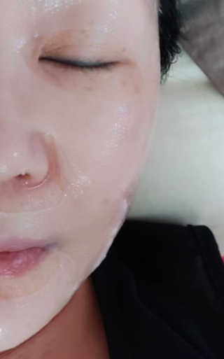 이너풀 하이 모이스처라이징 바이오셀룰로오스 마스크 — 5점을 준 리뷰어가 2020년 9월 올린 사용 사진