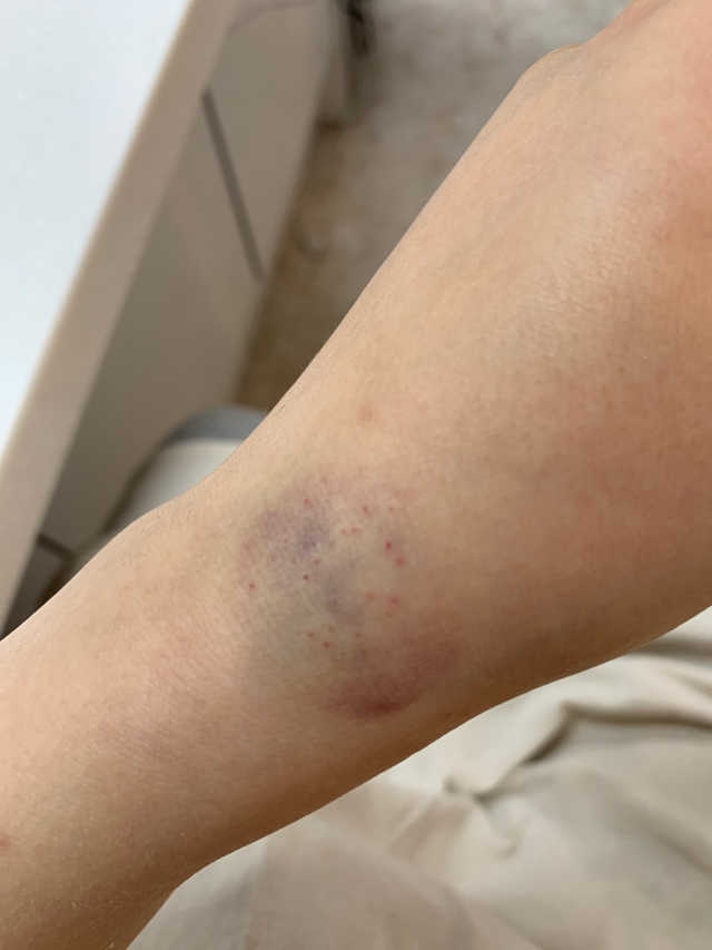 필캣 투명 실리콘 손목 보호대 케이스 1개 포함 리뷰 사진