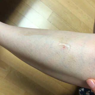 바이애콤 퓨어 카밍 수딩 젤 크림 — 5점을 준 리뷰어가 2020년 6월 올린 사용 사진