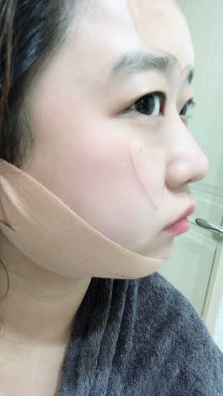 아이디플라코스메틱 아이디 페이스핏 마이너스 밴드 — 4점을 준 리뷰어가 2020년 4월 올린 사용 사진