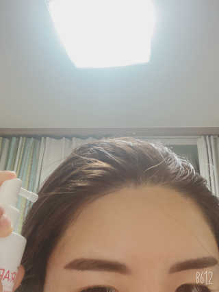 리더스코스메틱 리더스 헤어 라피 헤어 로스 컨트롤 토닉 — 4점을 준 리뷰어가 2020년 10월 올린 사용 사진