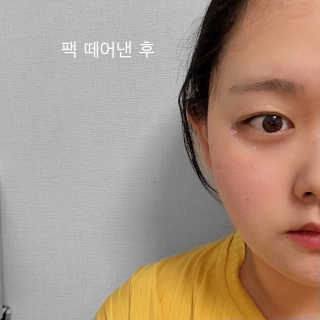 아이디플라코스메틱 페이스핏 플라스터 마스크 _ 리뉴얼 — 4점을 준 리뷰어가 2020년 11월 올린 사용 사진