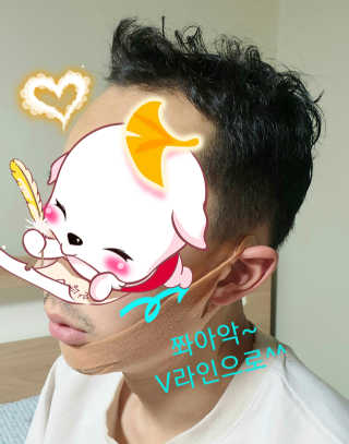 아이디플라코스메틱 아이디 페이스핏 마이너스 밴드 v2 — 5점을 준 리뷰어가 2020년 12월 올린 사용 사진