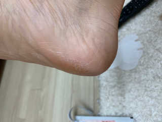 챔미님이 올린 리뷰 사진 2