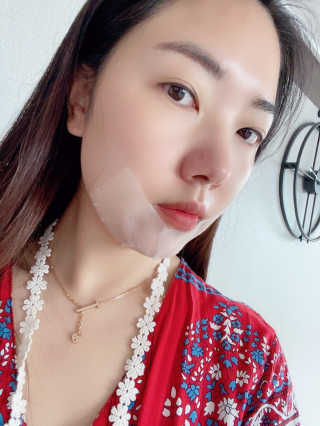 파머스시그니처 어성초, 작약뿌리, 흑미 추출물 3종 — 5점을 준 리뷰어가 2020년 8월 올린 사용 사진