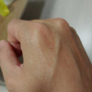 derma SC-Gel 더마에스씨 겔 20g — 리뷰어가 2020년 4월 올린 사용 사진
