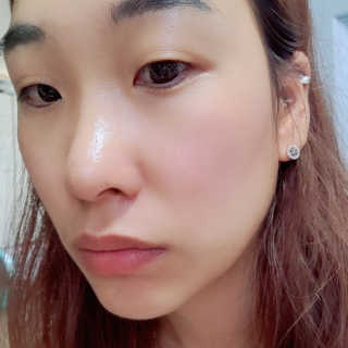 바베 BABE 바베 프로테오글리칸 F+F 앰플 솔루션 — 5점을 준 리뷰어가 2020년 10월 올린 사용 사진