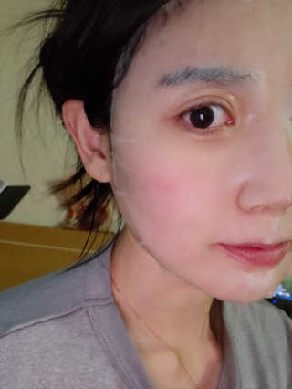 리더스코스메틱 리더스 시카 카밍  마스크 — 5점을 준 리뷰어가 2020년 5월 올린 사용 사진