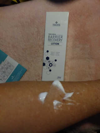 트리티스 [TREATIS] Barrier Recovery Lotion 200ml — 5점을 준 리뷰어가 2020년 11월 올린 사용 사진