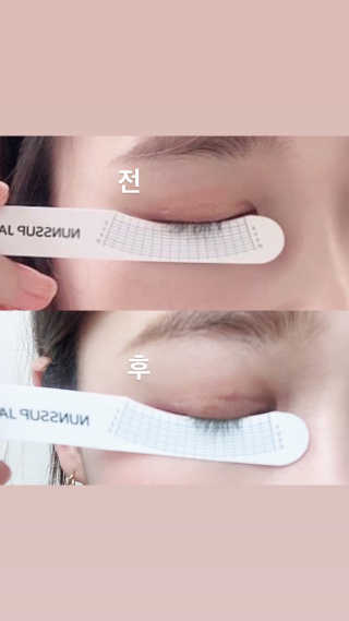닥터존스킨 눈썹자라 — 4.5점을 준 리뷰어가 2020년 8월 올린 사용 사진