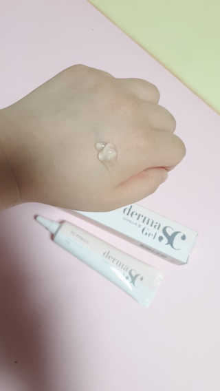 derma SC-Gel 더마에스씨 겔 20g — 5점을 준 리뷰어가 2020년 4월 올린 사용 사진
