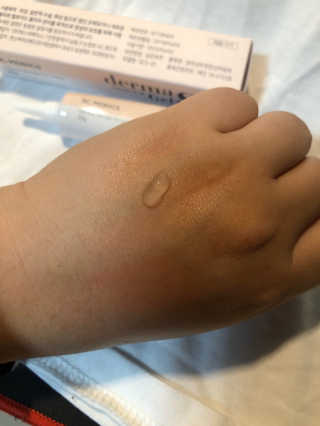 derma SC-Gel 더마에스씨 겔 20g — 5점을 준 리뷰어가 2020년 5월 올린 사용 사진