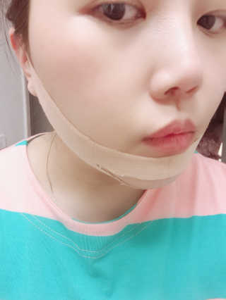 아이디플라코스메틱 아이디 페이스핏 마이너스 밴드 — 5점을 준 리뷰어가 2020년 4월 올린 사용 사진